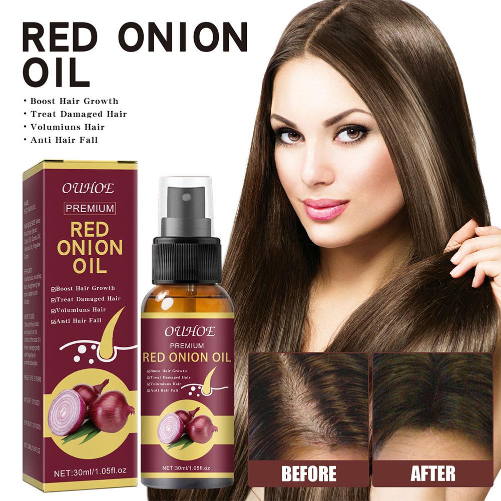 1/3/5PCS Red Onion Essential O – Hair Care With Rice Water Bewertung und Preis