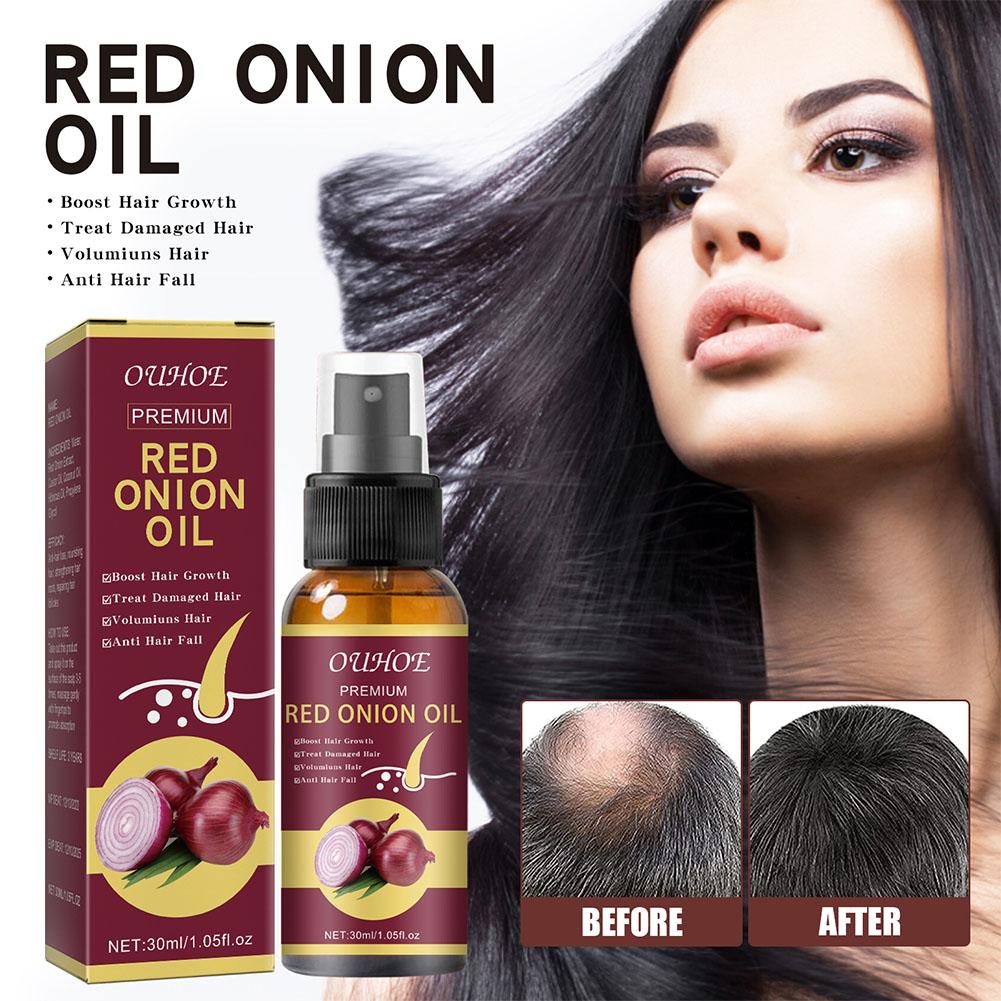 1/3/5PCS Red Onion Essential O – Hair Care With Rice Water Bewertung und Preis