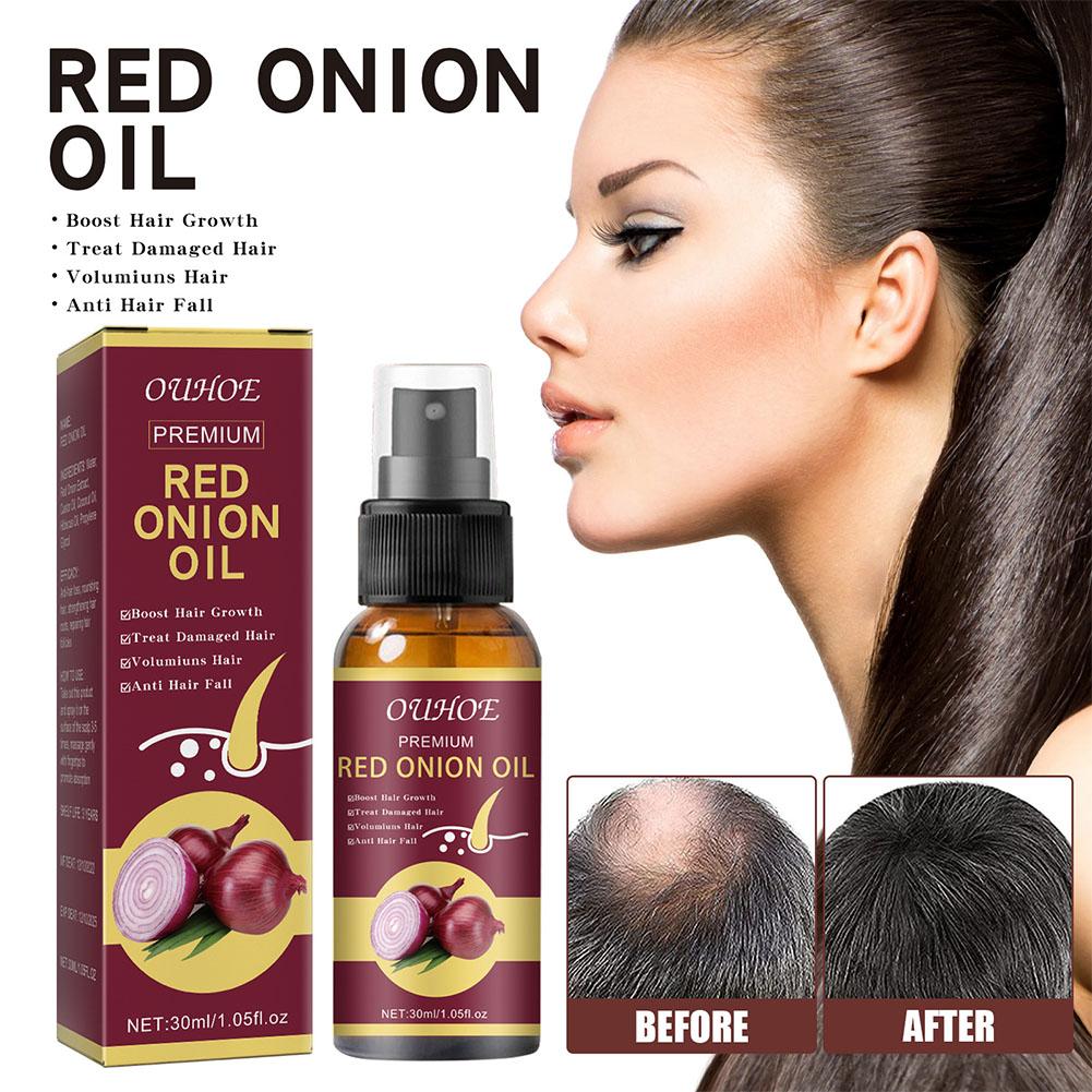 1/2/3pcs Red Onion Essential O – Hair Care With Rice Water Bewertung und Preis