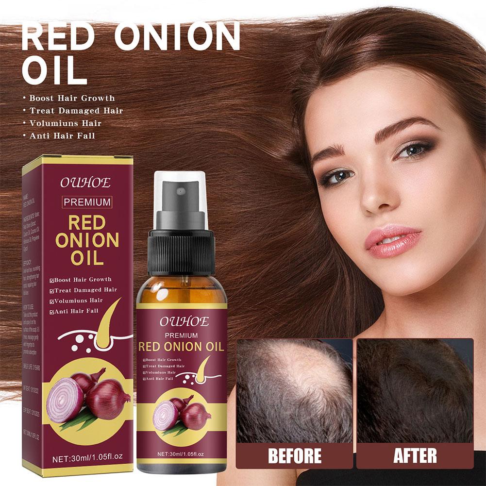 1/2/3pcs Red Onion Essential O – Hair Care With Rice Water Bewertung und Preis