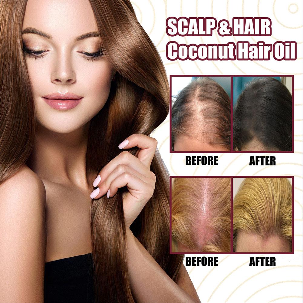 1/2/3pcs Red Onion Essential O – Hair Care With Rice Water Bewertung und Preis