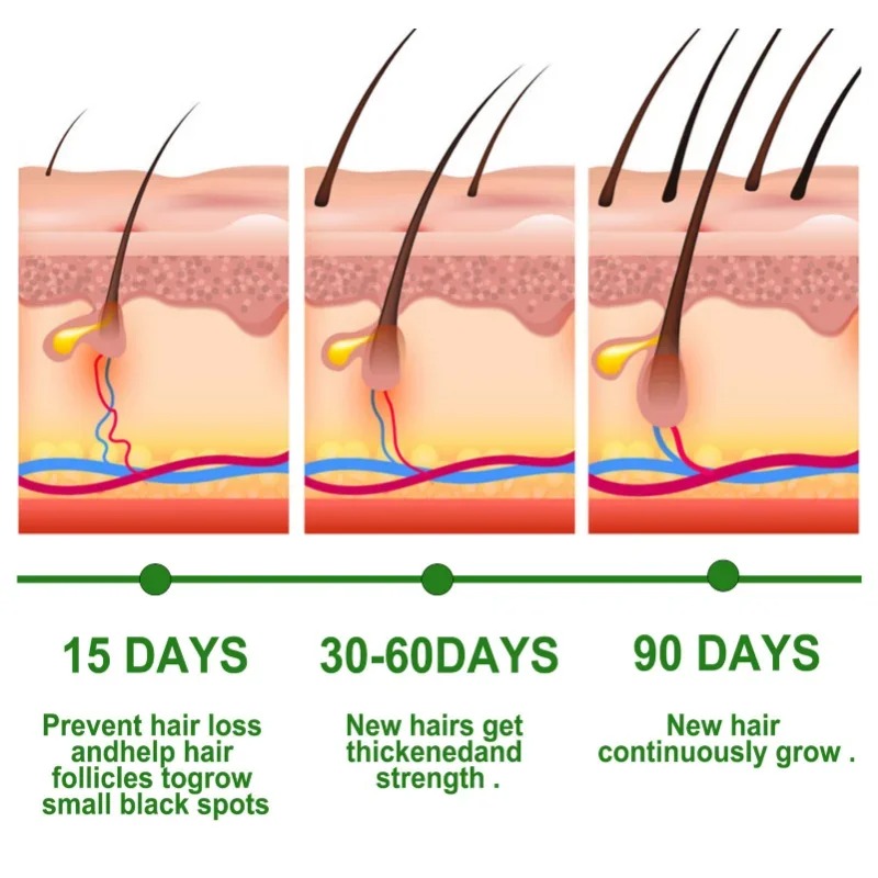 Hair Growth Serum Fast Growing – Hair Care Essential Oil Atomizing Bewertung und Preis