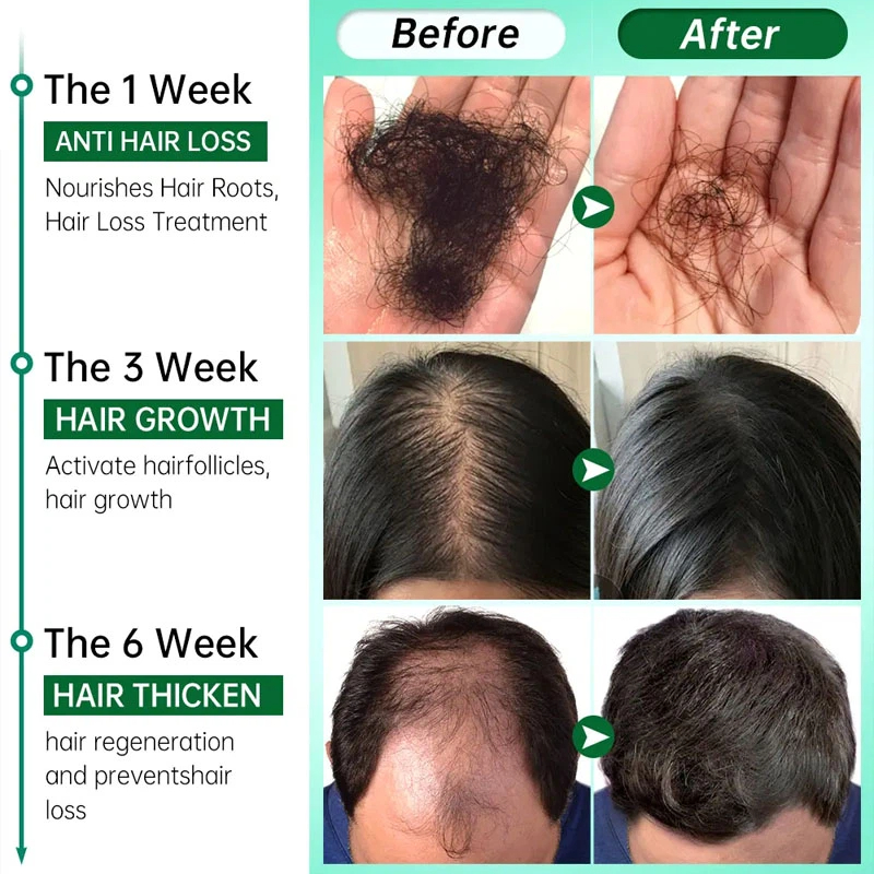 7 Days Fast Grow Hair Growth S – Hair Care Essential Oil Atomizing Bewertung und Preis