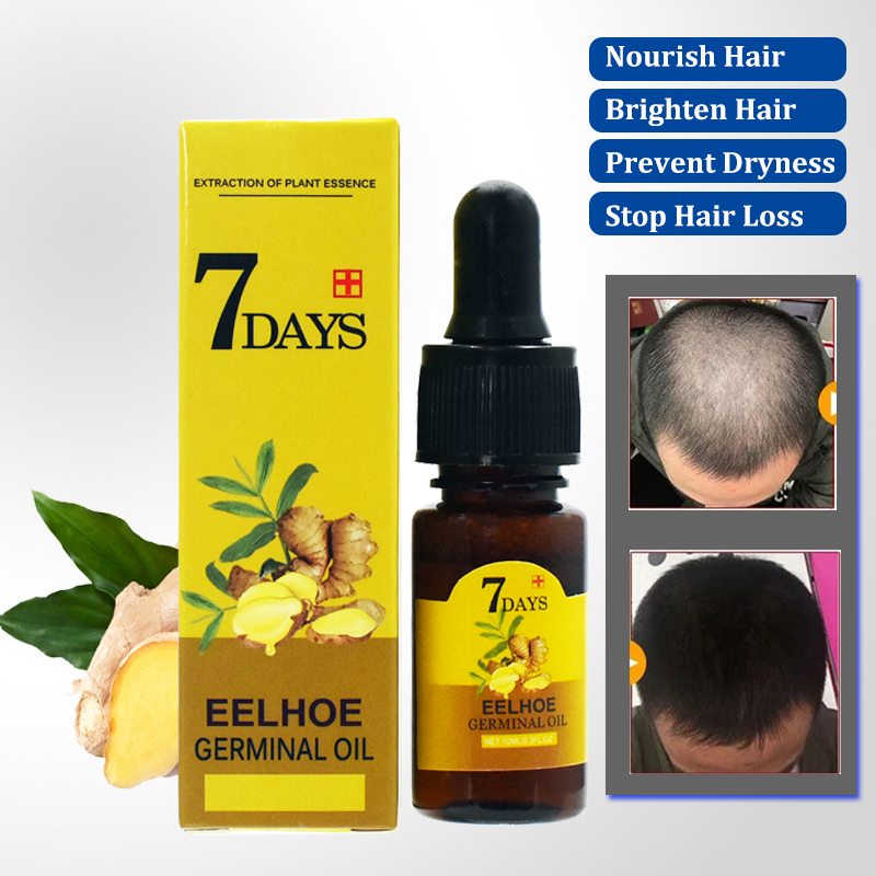 Ginger Hair Growth Essential O – Hair Care Essential Oil Atomizing Bewertung und Preis