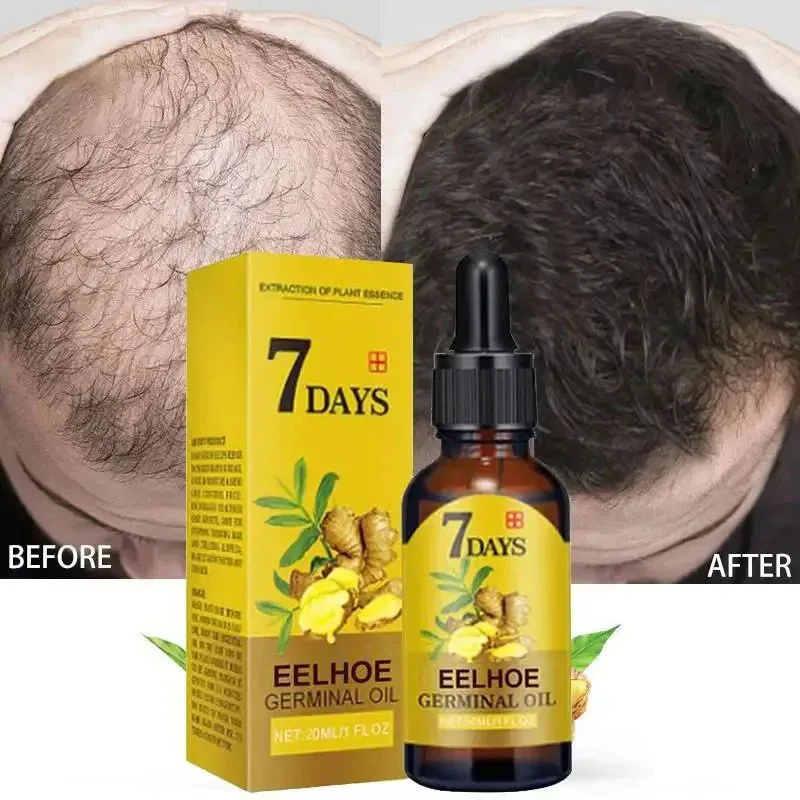 7 Day Fast Hair Growth Serum G – Hair Care Essential Oil Atomizing Bewertung und Preis