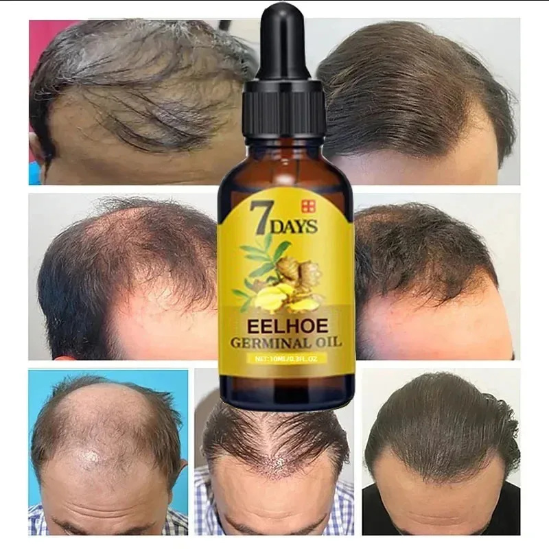 7 Day Fast Hair Growth Serum G – Hair Care Essential Oil Atomizing Bewertung und Preis