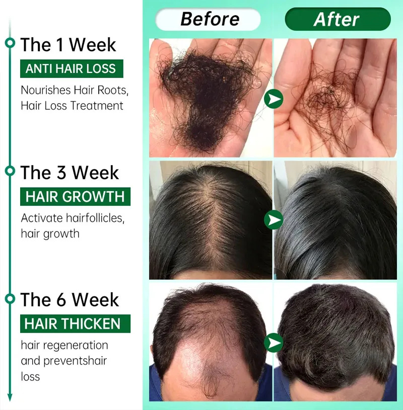 7 Day Fast Hair Growth Serum G – Hair Care Essential Oil Atomizing Bewertung und Preis