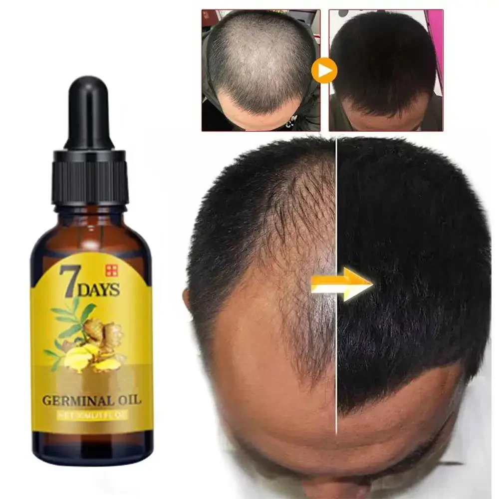 Hair Growth Ginger Fast Growin – Hair Care Essential Oil Atomizing Bewertung und Preis