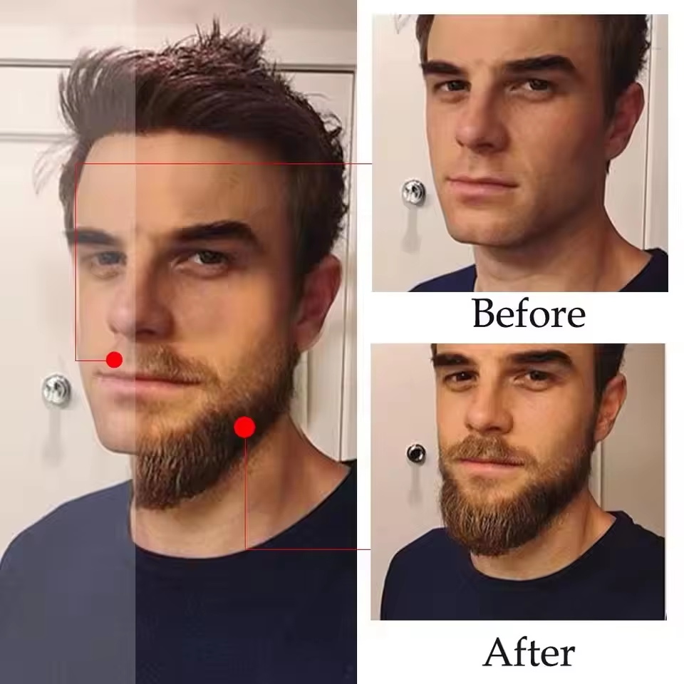 High Quality Fast Beard Growth – Hair Care Essential Oil Atomizing Bewertung und Preis