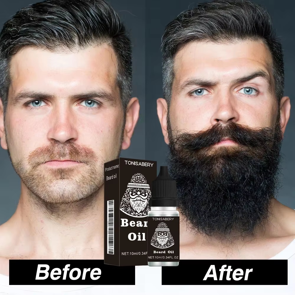 High Quality Fast Beard Growth – Hair Care Essential Oil Atomizing Bewertung und Preis